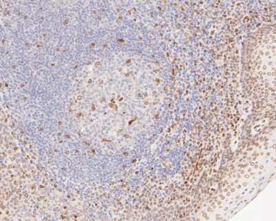 Immunohistochemistry-Paraffin: E2F-1 Antibody (JJ092-02) [NBP2-67899]