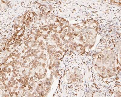 Immunohistochemistry-Paraffin: E2F-1 Antibody (JJ092-02) [NBP2-67899]