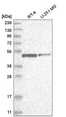 Western Blot: E2F-1 Antibody [NBP2-56716]