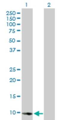 Western Blot: E2F-2 Antibody [H00001870-B01P]