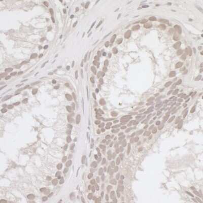 Immunohistochemistry-Paraffin: E2F-4 Antibody [NBP1-21374]