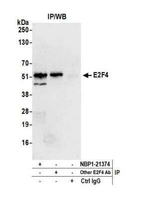 Immunoprecipitation: E2F-4 Antibody [NBP1-21374]