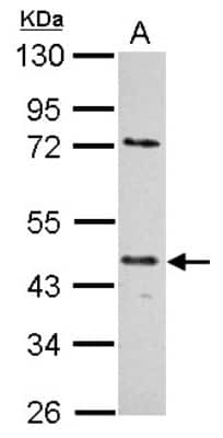 Western Blot: E2F-1 Antibody (18E10) [NB600-209]