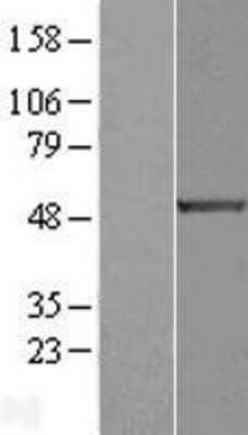 Western Blot: E2F-1 Overexpression Lysate [NBP2-07771]