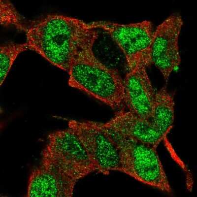 Immunocytochemistry/ Immunofluorescence: E2F3 Antibody [NBP2-57709]