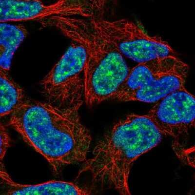 Immunocytochemistry/ Immunofluorescence: E2F3 Antibody [NBP2-68610]