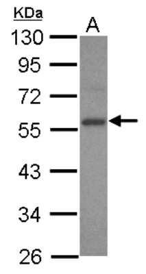 Western Blot: E2F3 Antibody [NBP2-16251]