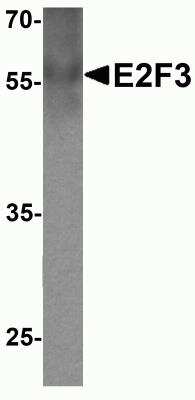 Western Blot: E2F3 AntibodyBSA Free [NBP2-81745]