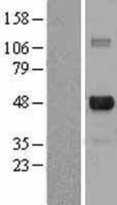 Western Blot: E2F-4 Overexpression Lysate [NBL1-10085]