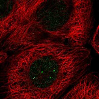 Immunocytochemistry/ Immunofluorescence: E2F5 Antibody [NBP2-56500]