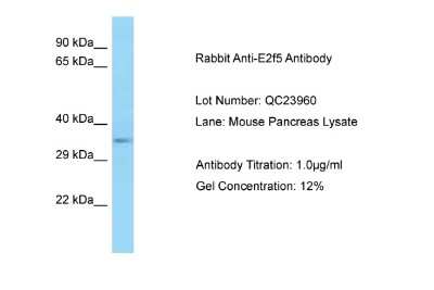 Western Blot: E2F5 Antibody [NBP2-82954]