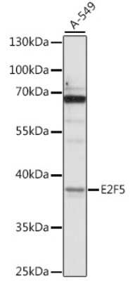 Western Blot: E2F5 AntibodyAzide and BSA Free [NBP2-92290]