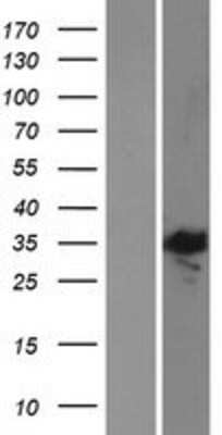 Western Blot: E2F5 Overexpression Lysate [NBP2-08161]