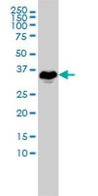 Western Blot: E2F6 Antibody (1F7-A9) [H00001876-M02]