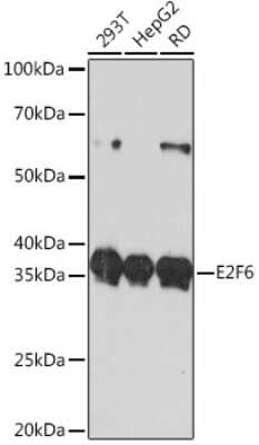 Western Blot: E2F6 Antibody (9I5M0) [NBP3-15400]