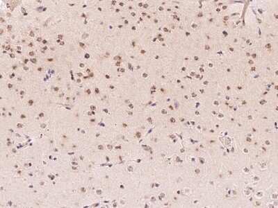 Immunohistochemistry: E2F6 Antibody [NBP2-99406]