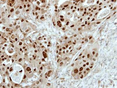 Immunohistochemistry-Paraffin: E2F6 Antibody [NBP2-14936]