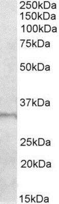 Western Blot: E2F6 Antibody [NBP1-46117]