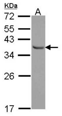 Western Blot: E2F6 Antibody [NBP2-14936]