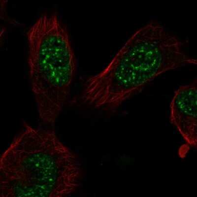 Immunocytochemistry/ Immunofluorescence: E2F7 Antibody [NBP2-57294]