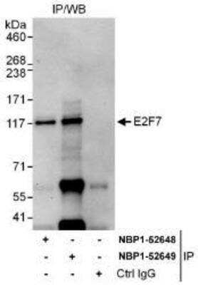 Immunoprecipitation: E2F7 Antibody [NBP1-52648]