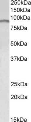 Western Blot: E2F7 Antibody [NBP1-26399]