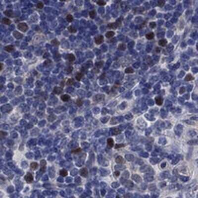 Immunohistochemistry-Paraffin: E2F8 Antibody [NBP3-17838]