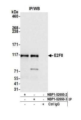 Immunoprecipitation: E2F8 Antibody [NBP1-52650]