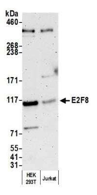 Western Blot: E2F8 Antibody [NBP1-52650]