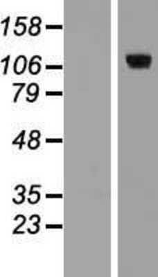 Western Blot: E2F8 Overexpression Lysate [NBP2-06299]