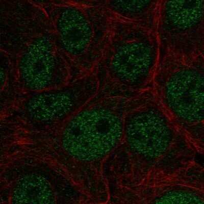 Immunocytochemistry/ Immunofluorescence: E4F1 Antibody [NBP2-56386]