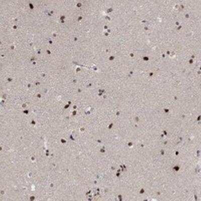 Immunohistochemistry-Paraffin: E4F1 Antibody [NBP3-17705]
