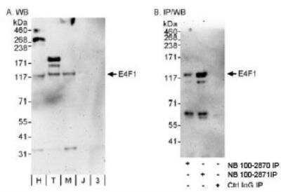 Western Blot: E4F1 Antibody [NB100-2870]