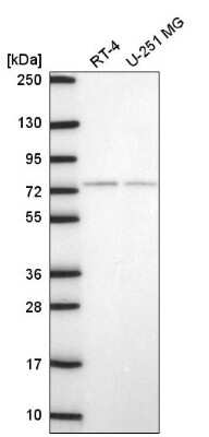 Western Blot: E4F1 Antibody [NBP2-56386]