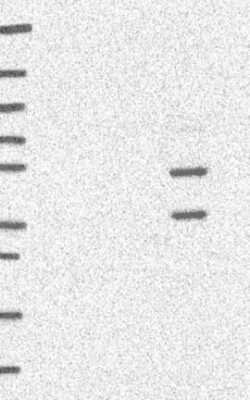 Western Blot: E4F1 Antibody [NBP3-17705]