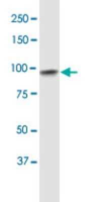 Western Blot: E6AP/UBE3A Antibody (2F6) [H00007337-M01]