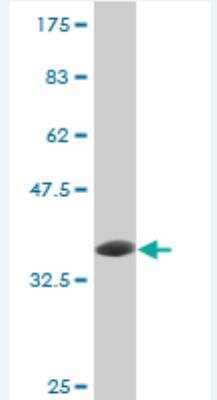 Western Blot: E6AP/UBE3A Antibody (3E5) [H00007337-M02]