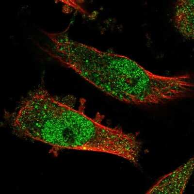 Immunocytochemistry/ Immunofluorescence: E6AP/UBE3A Antibody [NBP1-89092]