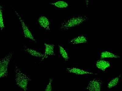 Immunocytochemistry/ Immunofluorescence: E6AP/UBE3A Antibody [NBP2-98953]