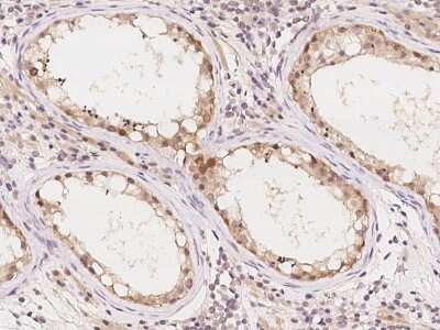 Immunohistochemistry-Paraffin: E6AP/UBE3A Antibody [NBP2-99342]