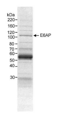 Western Blot: E6AP/UBE3A Antibody [NB500-239]