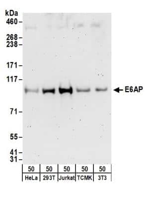 Western Blot: E6AP/UBE3A Antibody [NB500-239]