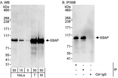 Western Blot: E6AP/UBE3A Antibody [NB500-240]