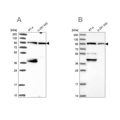 Western Blot: E6AP/UBE3A Antibody [NBP2-38463]