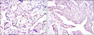 Immunohistochemistry: E7 Antibody (6F3) - BSA Free [NBP2-37628]
