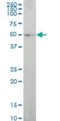 Western Blot: E74 like factor 1 Antibody (3B7) [H00001997-M01]