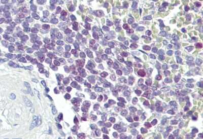 Immunohistochemistry: E74 like factor 1 Antibody [NBP3-10893]