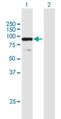 Western Blot: E74 like factor 1 Antibody [H00001997-B01P]