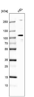 Western Blot: E74 like factor 1 Antibody [NBP1-90352]