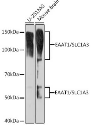 Western Blot: EAAT1/GLAST-1/SLC1A3 Antibody (7Y4U5) [NBP3-16865]